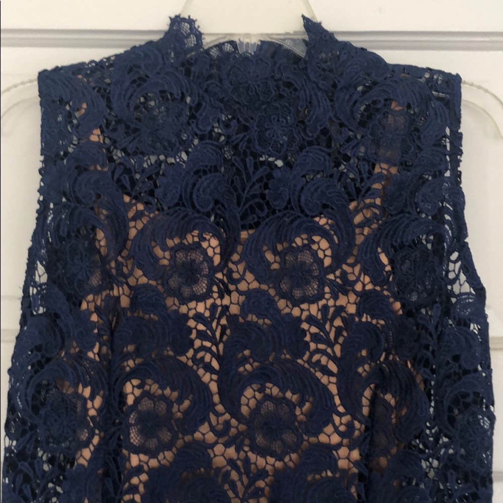 LACE DRESS 💙